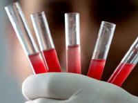 Trasfusioni con sangue artificiale entro il 2017.